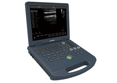 DW-PE522,全數(shù)字彩色多普勒超聲診斷儀,推車式彩超