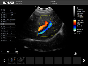S8便攜筆記本獸用彩超機-寵物b超機掃描圖